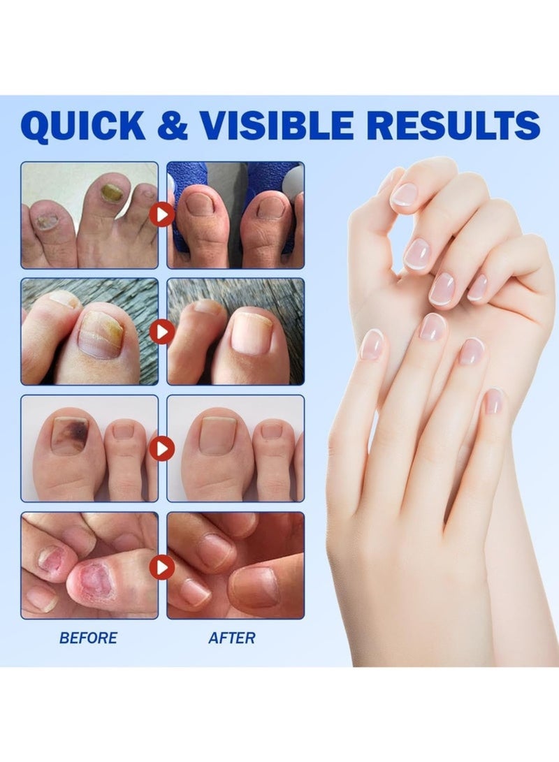 saykfoe 21Pcs Fungal Nail Patch Nail Treatment, Renews Nails Structure and Improve Discoloration Overnight 8Hrs Nighttime Renewal Fungal Nail Patches - Image 3
