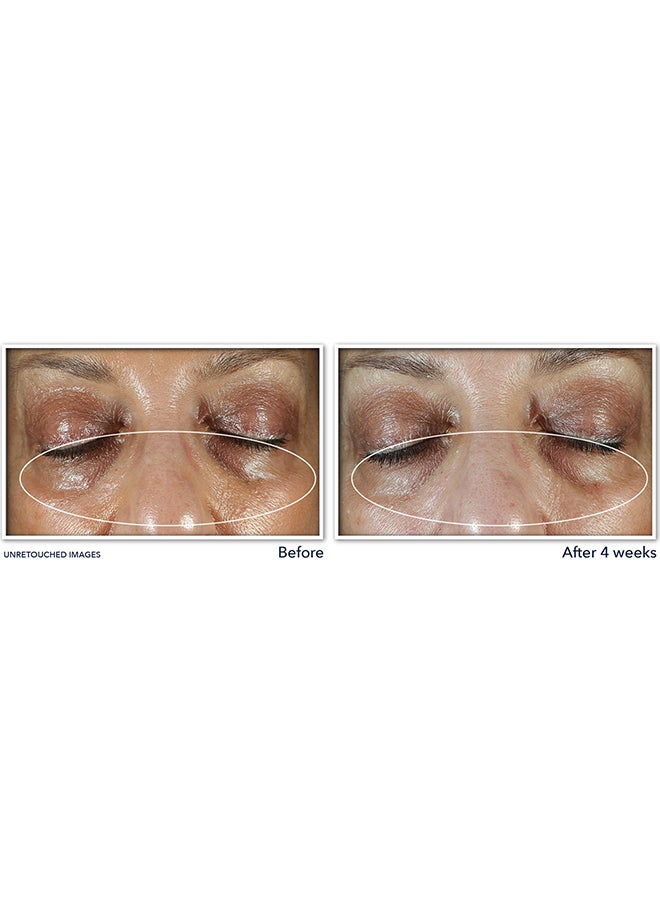 RoC - Multi Correxion Even Tone + Lift Eye Cream 15Ml Eu/Ca (Reno) - Image 1