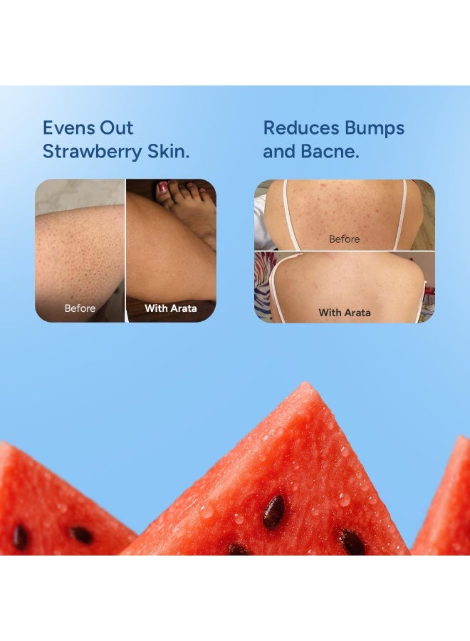 ARATA 1% Salicylic Acid Body Wash I 300 ML I Removes Back Acne I Improves Strawberry Skin I Cleanses, Smoothens and Exfoliates Skin I Prevents Body Acne and Bumps I with Watermelon Fragrance - Image 2