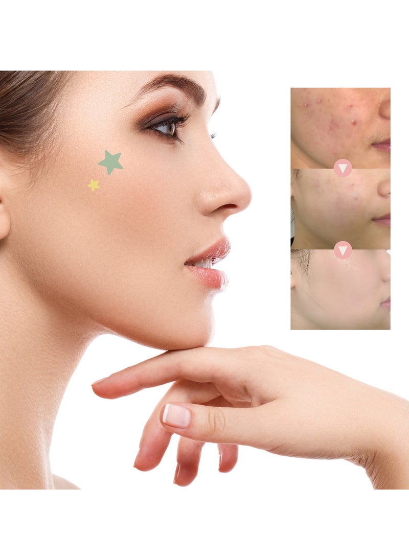 OUHOE Pimple Patch Acne Treatment Patches for Clear Skin - Waterproof, Breathable, Tone-Perfecting, Conceals Acne Marks and Suitable for Makeup  - Image 4