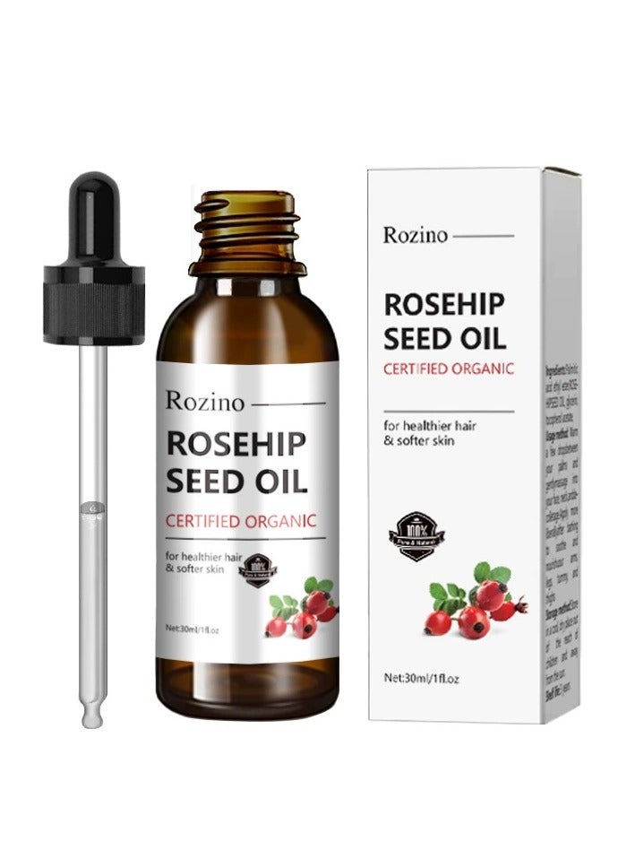 روزينو زيت ثمر الورد ، زيت بذور ثمر الورد العضوي من الفاكهة والبذور للعناية بالبشرة ، زيت مرطب ومغذي مضاد للشيخوخة للبشرة والشعر والأظافر ، معصور على البارد غير مكرر لجميع أنواع البشرة والشعر 30 مل - Image 1