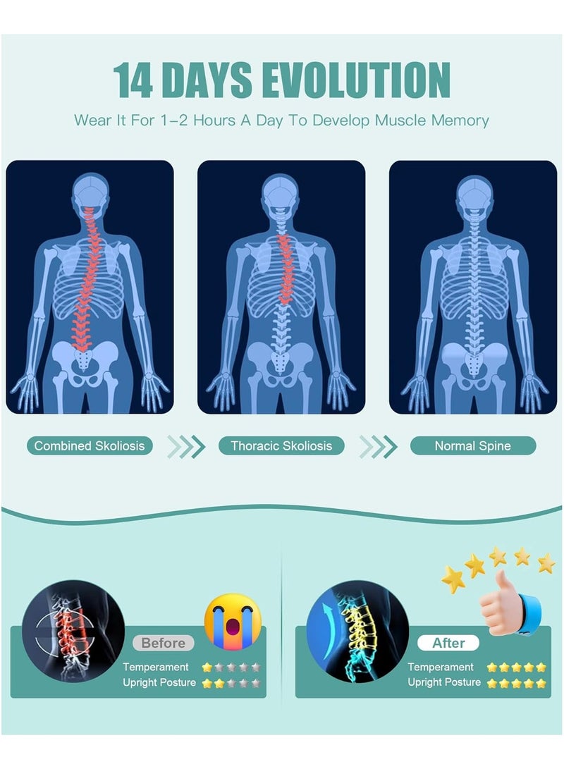 Back Brace Posture Corrector for Women and Men - Full Back Support for Improving Posture & Correcting Scoliosis Hunchback for Soothing Upper and Lower Back Lumbar Neck Shoulder Discomfort (Size:M) - Image 5