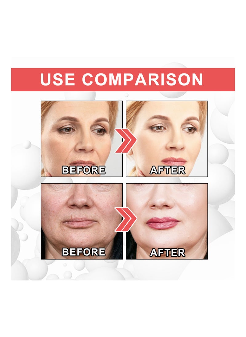EELHOE - Collagen Boost Anti-Aging Serum  Collagen Boost Serum Collagen Anti-Wrinkle Cream Anti Aging Serum For Women Collagen Booster For Face With Hyaluronic Acid 30ML - Image 1