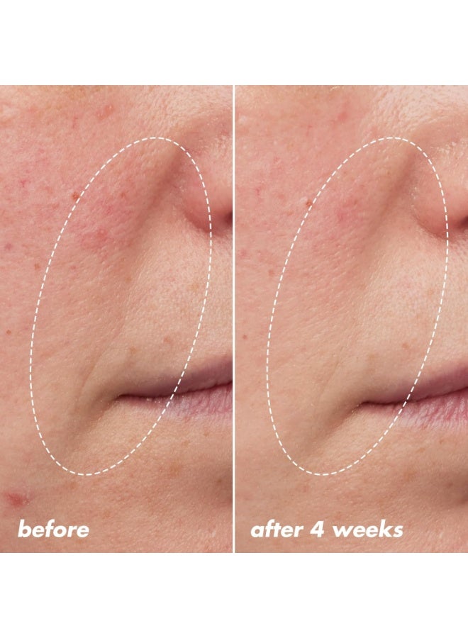 إلف زيت ليلي معزز لشباب البشرة، زيت لطيف على الوجه طوال الليل، يعالج الخطوط الدقيقة والملمس غير المتساوي - Image 2