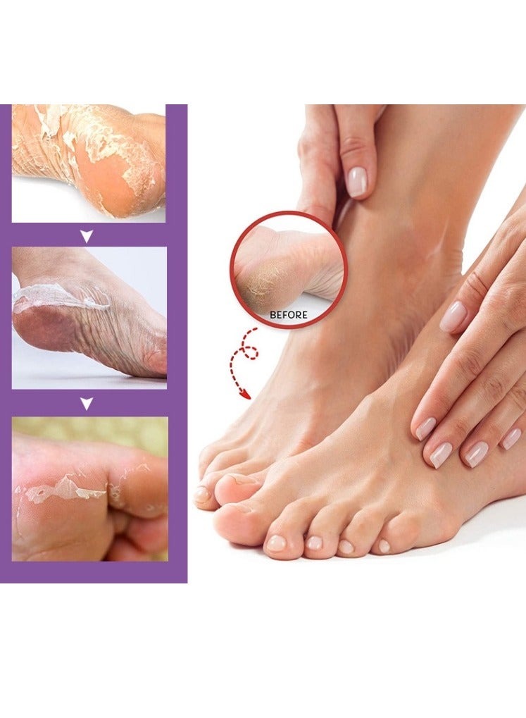 efero 2 Pairs Honey Milk Foot Mask For Dry Cracked Feet,Remove Dead Skin Niacinamide Moisturizing Foot Mask Moisturizing Repairing Nourishing Exfoliating Smooth Skin Care Dry Cracked Feet,Remove Dead Skin - Image 2