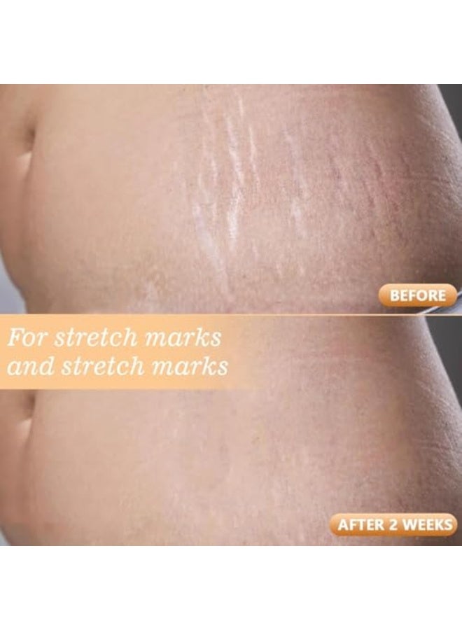 القمر الغربي نيجويدتي زيت الجسم السحري | زيت تدليك بفيتامينات للبشرة المتألقة | مع الجوجوبا والخروع وإكليل الجبل | مرطب وشد للبشرة الجافة | 100 مل - Image 4