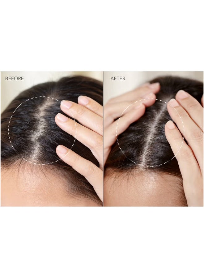 FOREO LUNA 4 hair - Image 4