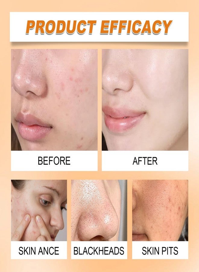 Tbexem غسول وجه بالكركم + وسادات تنظيف بالكركم، وسادات تنظيف بالكركم 100% طبيعية، تقلل من العيوب والمناطق الداكنة، تنظيف يومي، تنظف البشرة، عناية لطيفة بالبشرة (1 مجموعة) - Image 2