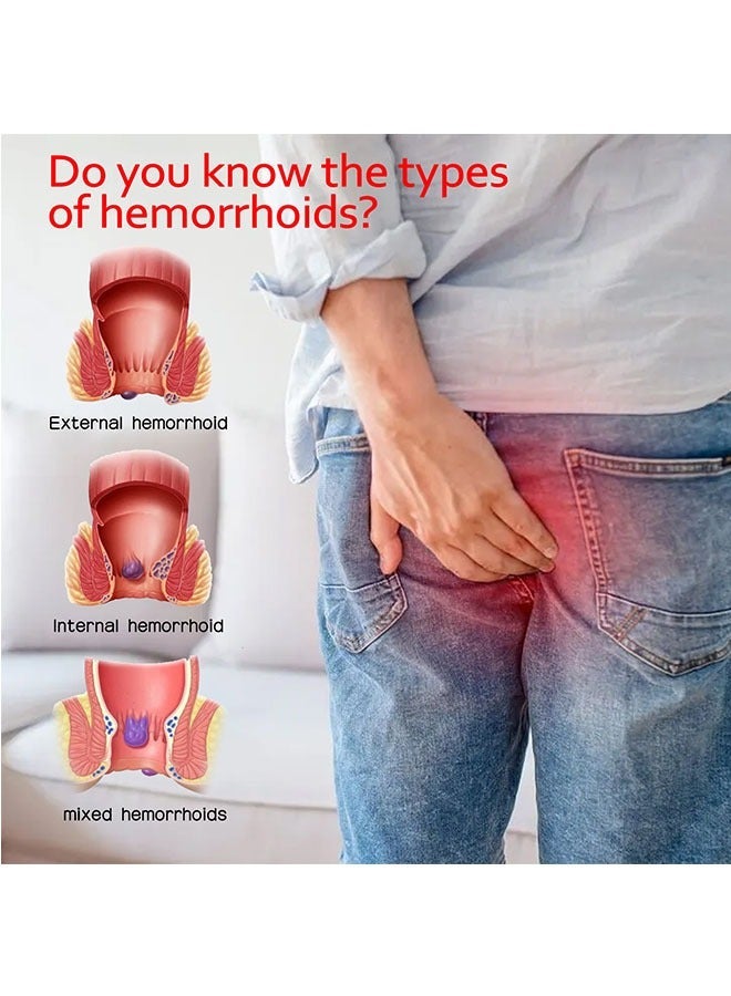 أبترين الطب الصيني التقليدي لعلاج البواسير البواسير مرهم مرهم لعلاج البواسير ، وتخفيف الألم ، الحكة ، وعدم الراحة ، وتخفيف الألم تورم البواسير - Image 2