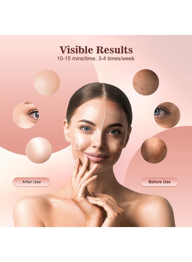INTEO Red Light Therapy for Face, 3 Modes Portable Led Face Mask Light Therapy with Remote, Infrared Light Mask with Timing Function, Led Light Therapy At Home, Pink - Image 3
