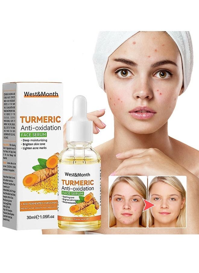 West&Month - Turmeric Dark Spot Corrector Serum, Turmeric Repair Face Serum, Bright Skin Dark Spot Corrector Face Whitening Serum, Hydrate Dull & Dry Skin (30ML) - Image 1