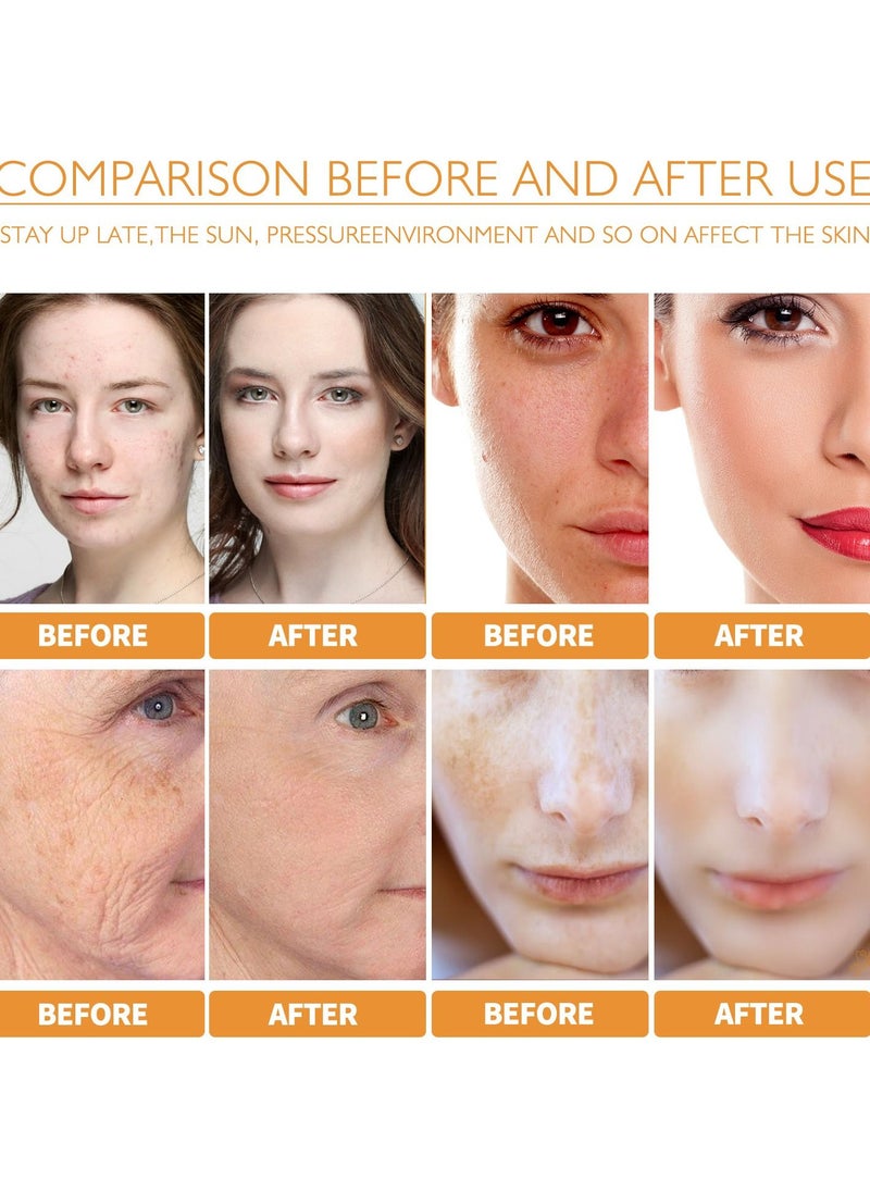 West&Month - Turmeric Dark Spot Corrector Serum, Turmeric Repair Face Serum, Bright Skin Dark Spot Corrector Face Whitening Serum, Hydrate Dull & Dry Skin (30ML) - Image 1