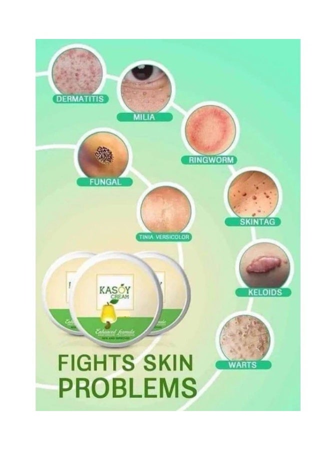 ANGEL TOUCH Kasoy Angel Touch Cream 5g – Herbal Skin Care Formula for Wart & Skin Tag Reduction - Image 4