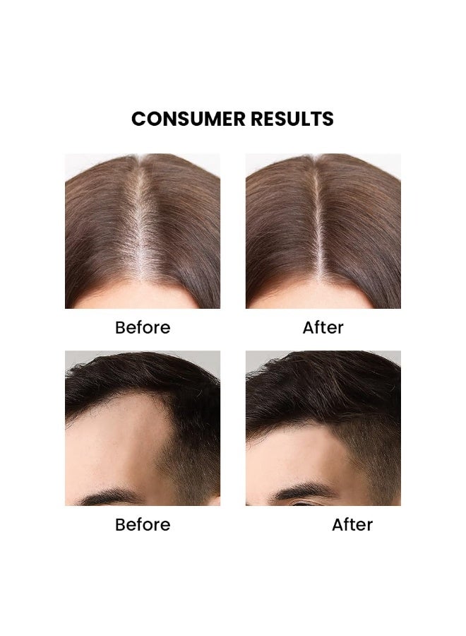 ثريفيكو زيت إكليل الجبل العطري من ثرايف كو | يساعد على تعزيز نمو الشعر والتحكم في تساقطه | نقي وعضوي 100% | غني بفيتامين E | يقوي الشعر ويدعم صحة فروة الرأس | مناسب للرجال والنساء | 15 مل - Image 4