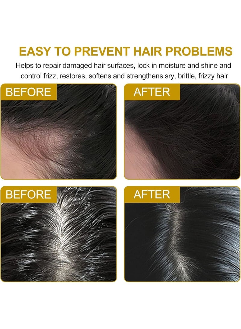 SOLARAE Ginger Hair Regrowth Shampoo Bar, 2 Pcs Natural Ginger Shampoo Bar, Anti Dandruff, Hair Loss Treatment, Promotes Hair Growth for All Hair Types - Image 2