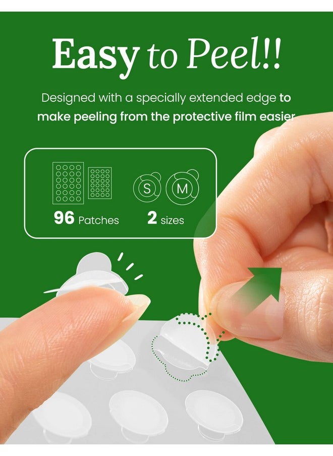 Troubless Troubless Invisible Pimple Spot Patch - 96 Ultra Thin Acne Patches - Easy Peel - 2 Sizes  - Image 4