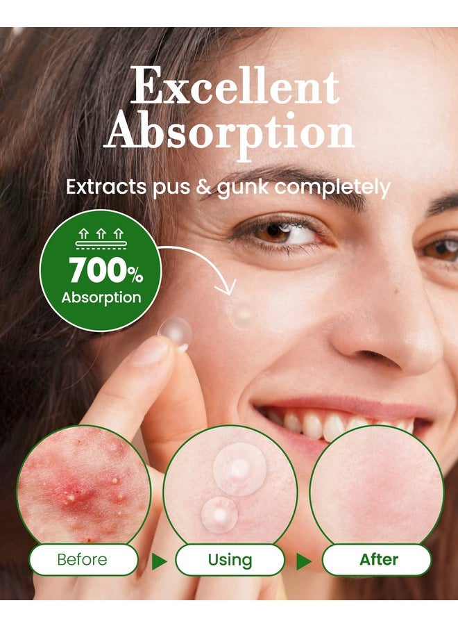 Troubless Troubless Invisible Pimple Spot Patch - 96 Ultra Thin Acne Patches - Easy Peel - 2 Sizes  - Image 5