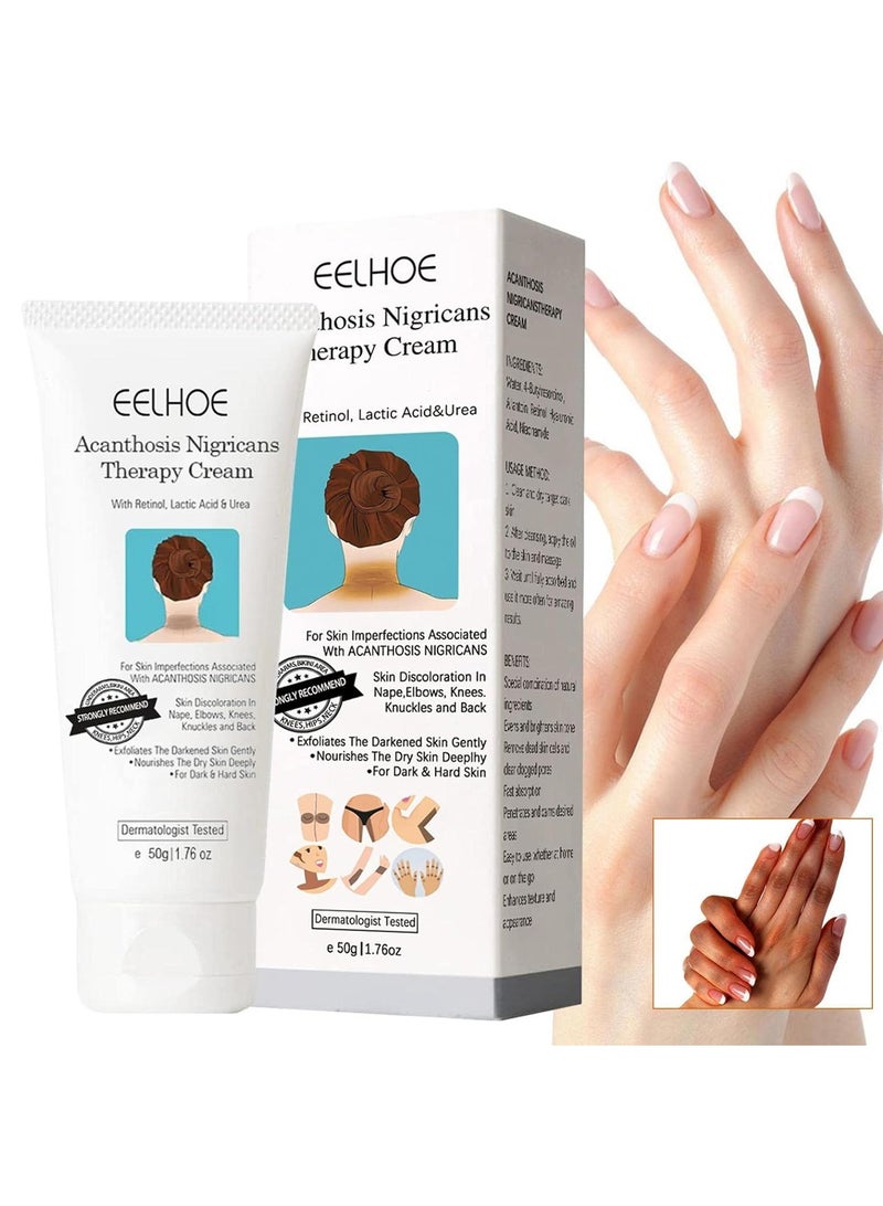 EELHOE Acanthosis Nigricans Therapy Cream, Dark Spot Corrector Cream Whitening Serum, Acanthosis Nigricans Treatment, Dark Spot Removal (1PCS) - Image 1