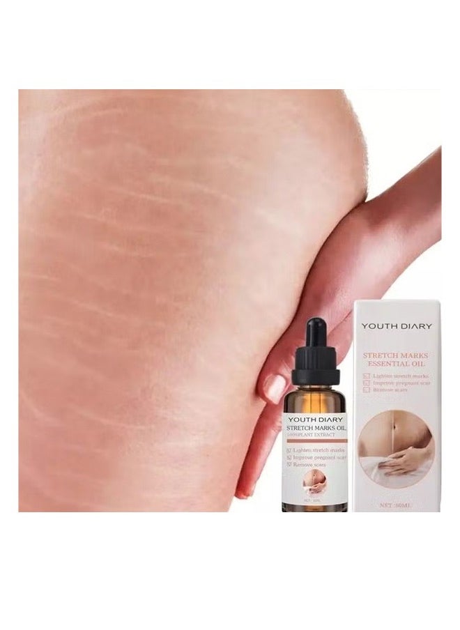 YOUTH DIARY - Youth Diary Stretch Marks Remover, Essential Oil Skin Care Treatment For Stretch Mark, Removal Maternity Slackline & Scar Removal,100% natural pure plant extract 50ml - Image 1