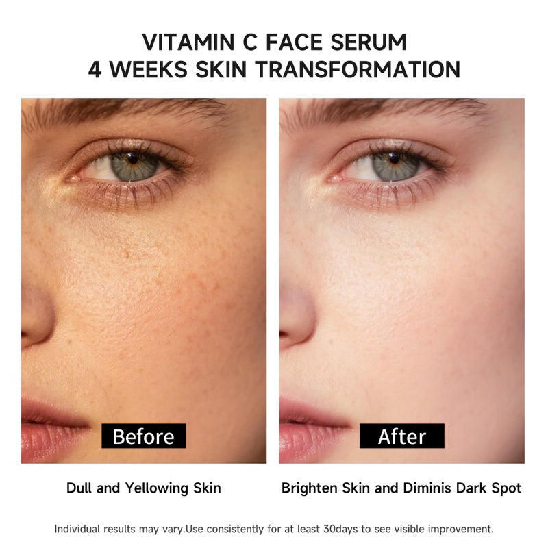 BACHERI Vitamin C Face Serum with Glutathione, 4D Hyaluronic Acid & Aloe Vera â€“ Lightweight Brightening & Hydrating Ampoule for Daily Skincare, Dark Spots, Sensitive Skin Friendly - (1.0 ml)*30 Vials - Image 3