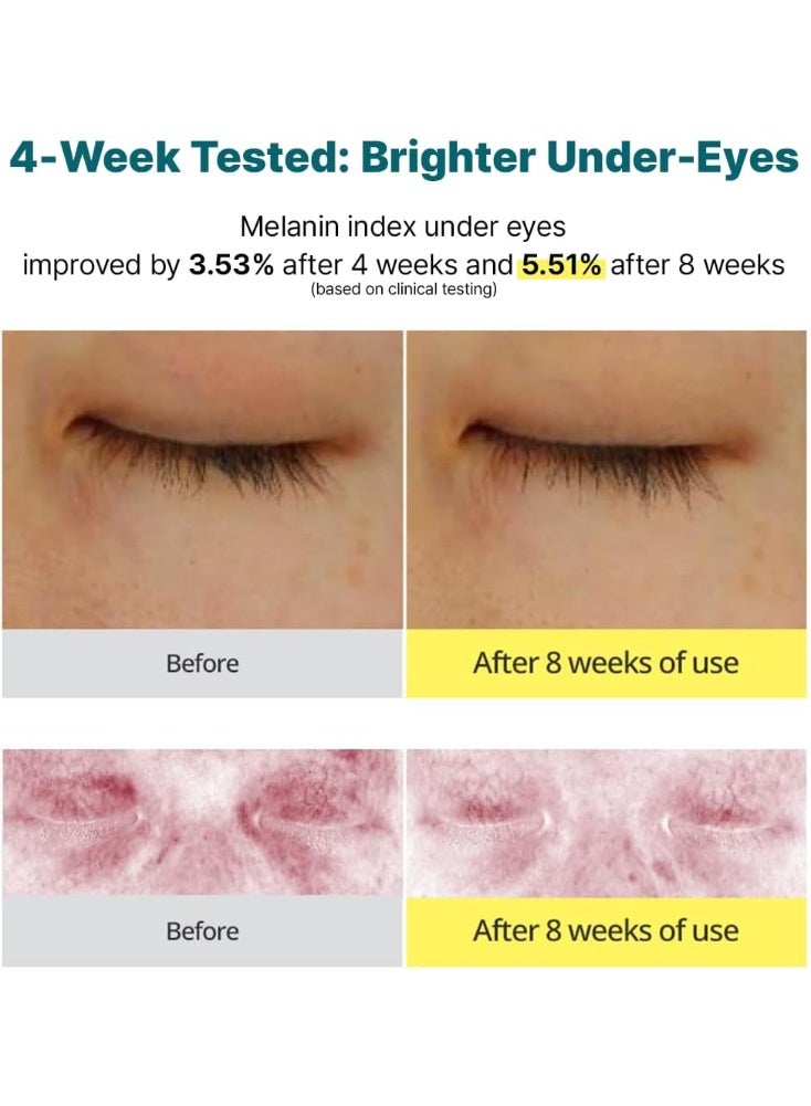 كريم جودال الأخضر باليوسفي وفيتامين سي للهالات السوداء حول العينين | علاج مكثف للهالات السوداء ومرونة البشرة، لطيف، غير مهيج، مضاد للشيخوخة والتجاعيد (30 مل) - Image 4