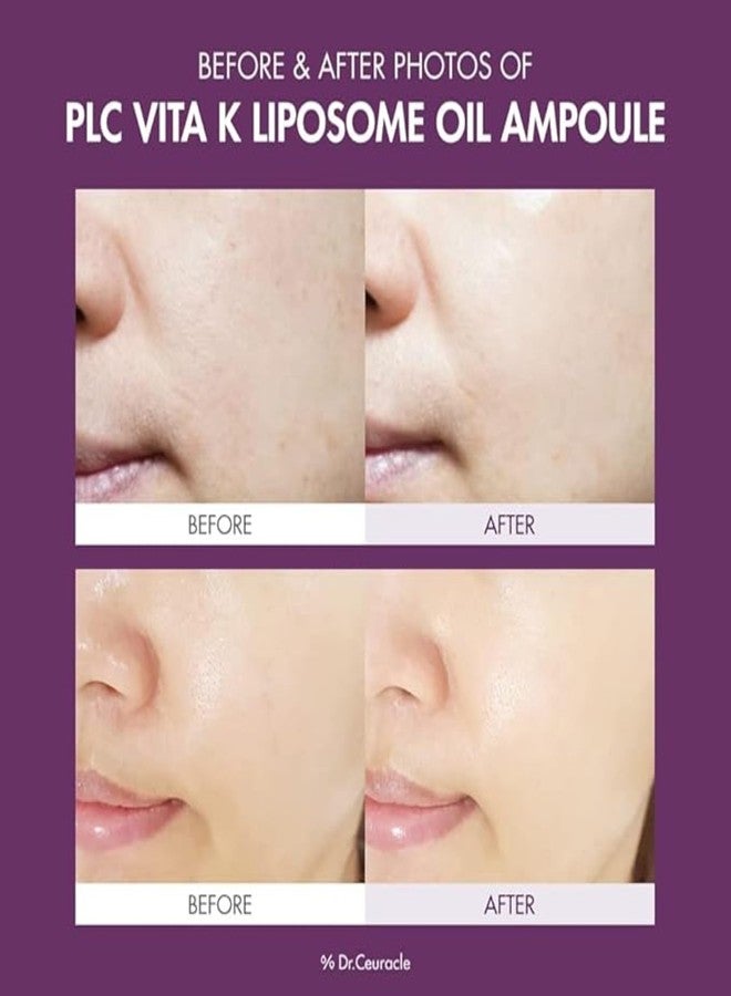 leegeehaam Dr.Ceuracle PLC Vita K Liposome Oil Ampoule - Post Laser Care with Vitamin K, Glowing Serum for Uneven & Dull Skin, Korean Skincare (50 ml / 1.69 fl. oz. - Image 2