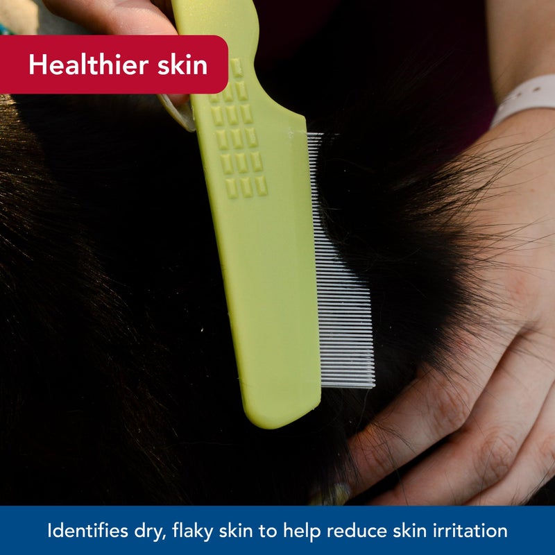 Coastal Pet Safari Cat Flea Comb - Tick & Flea Comb for Cats - Avoid Dry Skin - One Size - Image 4