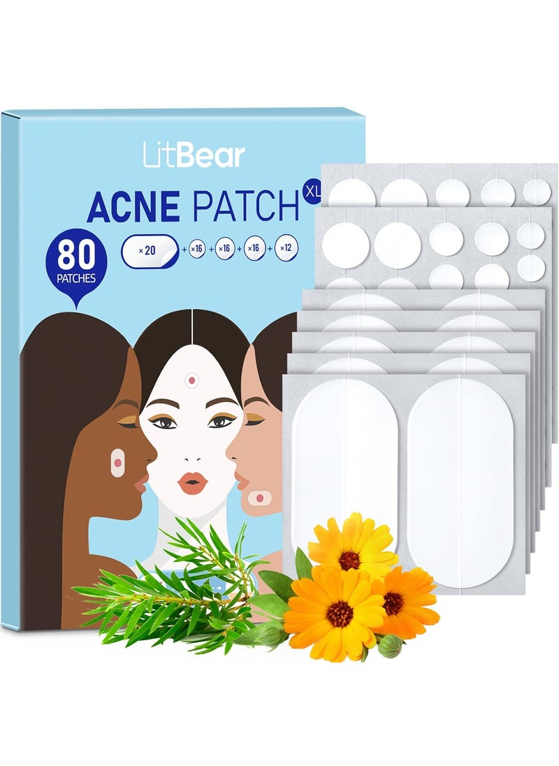 LitBear LitBear Large Acne Pimple Patches 5 Sizes 80 Patches for Large Breakouts Acne Patches for Face Chin or Body Acne Spot Patch with Tea Tree  Calendula Oil Hydrocolloid Bandages for Acne Skin 