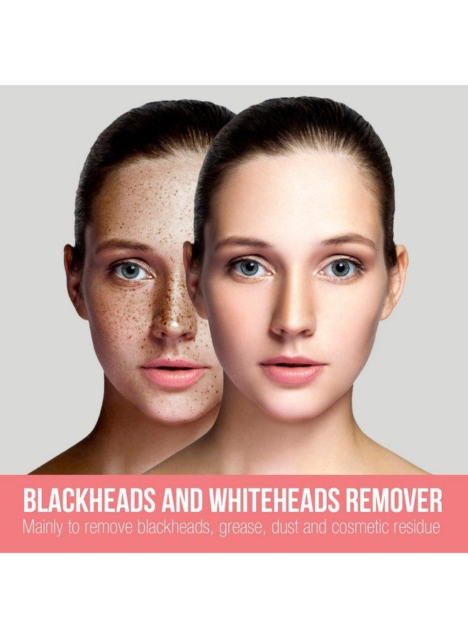 Havells Sc5060 Pore Cleanser Blackhead/Whitehead Remover 3 Suction Modes Low/Medium/High Fast Charge (White) - Image 3