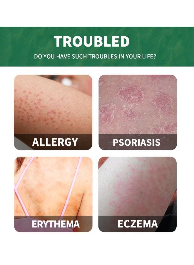 SOUTH MOON Natural Chinese Herbal Eczema Psoriasis Creams，Dermatitis and Eczema Pruritus Ointment， Psoriasis Treatment，Antibacterial Cream Skin Treatment Antipruritic cream，Faster Relief，Acne Removing Cream.  - Image 4