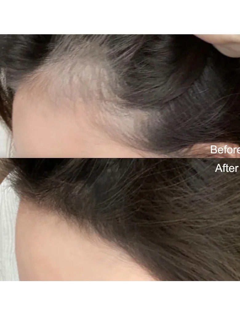 Gege bear Hairline Powder Stick, Natural Hairline Dye Contour Stick, Root Touch Up Instant Cover Concealer Powder, Sweat Resistant And Waterproof Hairline Repairing Pen, (Dark Brown Color) - Image 2