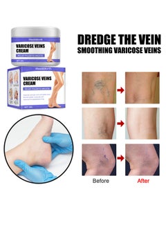 West&Month Vein Care Fading Cream, Spider Leg Fading Cream, Varicose Veins Treatment Cream, Improve The Apperance of Legs and Blood Circulation, Relief Tired  - Image 3