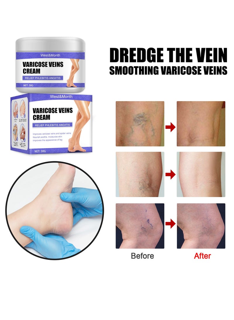 West&Month Vein Care Fading Cream, Spider Leg Fading Cream, Varicose Veins Treatment Cream, Improve The Apperance of Legs and Blood Circulation, Relief Tired - Image 3