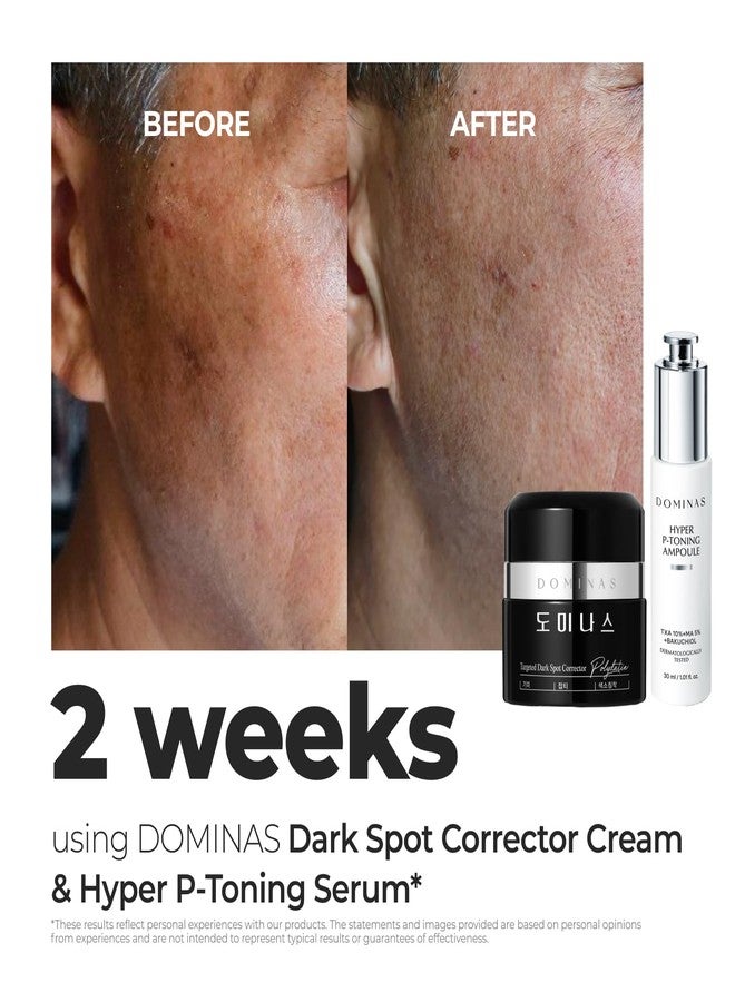 DOMINAS Tranexamic Acid Dark Spot Corrector Cream - Visibly Reduce Age Spots, Sun Spots with TXA, Niacinamide, Bakuchiol, Daily Moisturizer for Uneven Tone & After Spot Care, Korean Skincare, 1.76 oz - Image 4