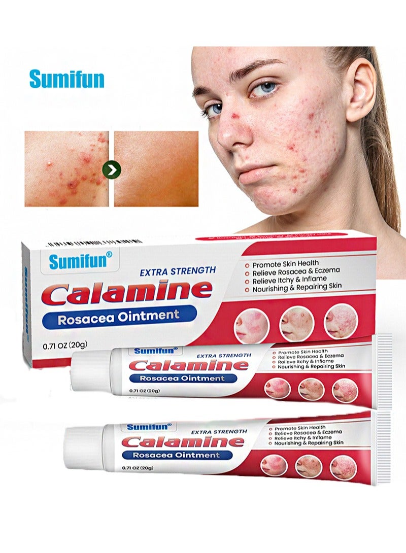 سوميفون قطعتان من مرهم الكالامين الوردي، يخفف من حكة الجلد واحمراره، ويحسن حب الشباب - Image 1