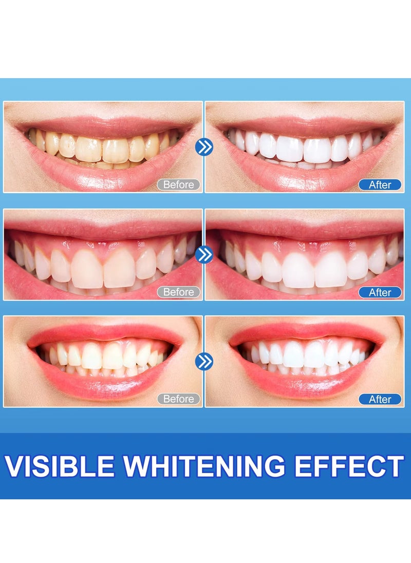 Yecuce 28pcs 9D Teeth Whitening Strips Upgraded Teeth Whitener Strips Enamel Safe Sensitive Teeth Whitening Individual Strips Gel Teeth Cleaning Strips for Fast Remove Yellowing Tooth Strips  - Image 2
