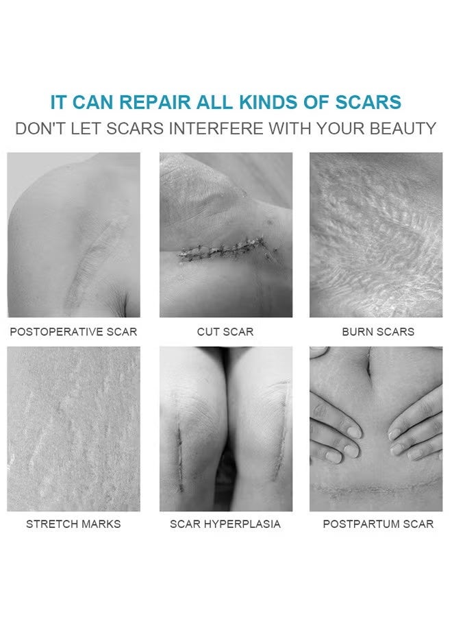 LANEMAY Scar Cream, Medical Grade Silicone Scar Cream Advanced Scar Removal Gel For Surgical Scars Stretch Marks Acne Injury Burns Keloids Hypertrophic Old And New Scars 20G - Image 5
