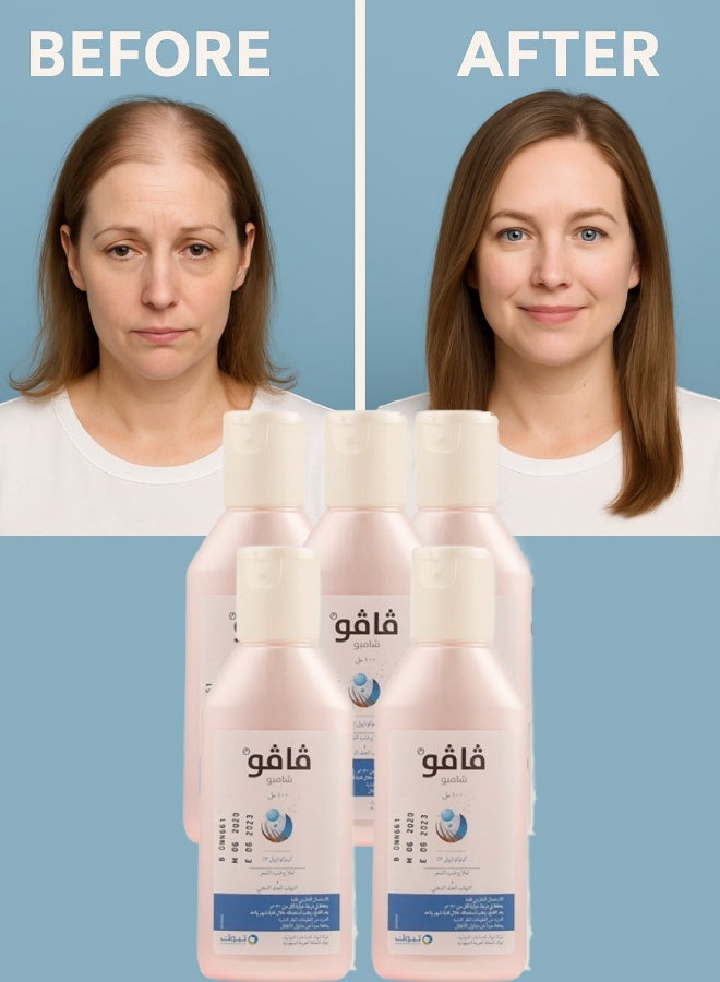 فافو 5 قطع فافو 2% شامبو 100مل - Image 1