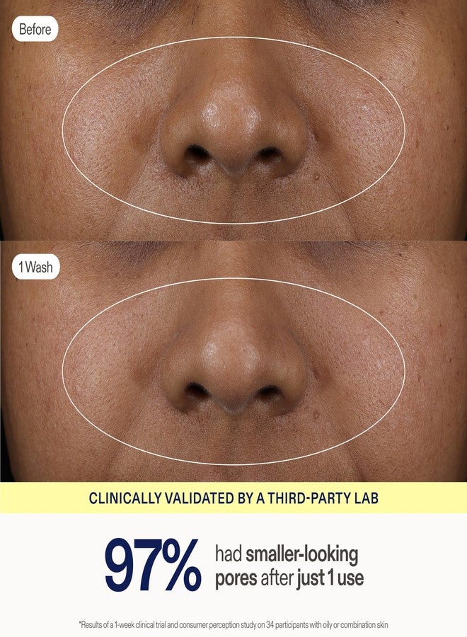 Skinfix Balancing Soft-Foam Clay Cleanser - Purifies, Unclogs + Minimizes Pores Like a Mask - For Oily/Combination & Acne-Prone Skin - Image 3