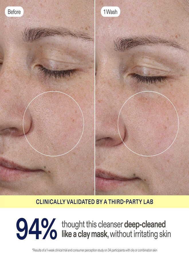 Skinfix Balancing Soft-Foam Clay Cleanser - Purifies, Unclogs + Minimizes Pores Like a Mask - For Oily/Combination & Acne-Prone Skin - Image 5