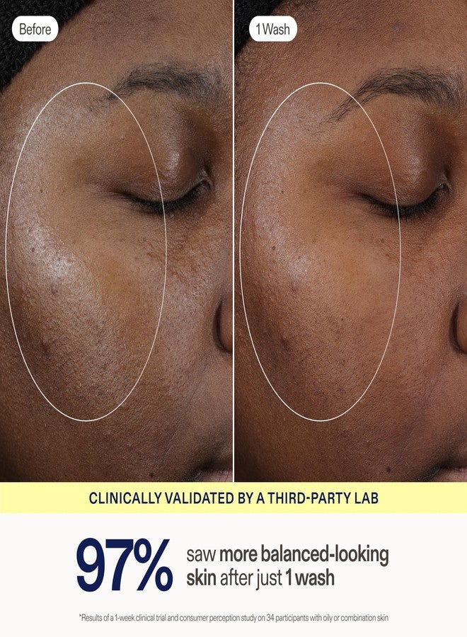 Skinfix Balancing Soft-Foam Clay Cleanser - Purifies, Unclogs + Minimizes Pores Like a Mask - For Oily/Combination & Acne-Prone Skin - Image 4
