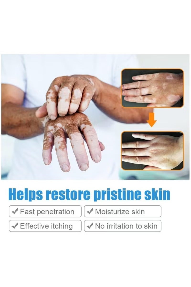 سوميفون كريم العناية بالبشرة فيتيليغو ، يقلل من البقع البيضاء ، وتحسين صبغة الجلد - Image 2