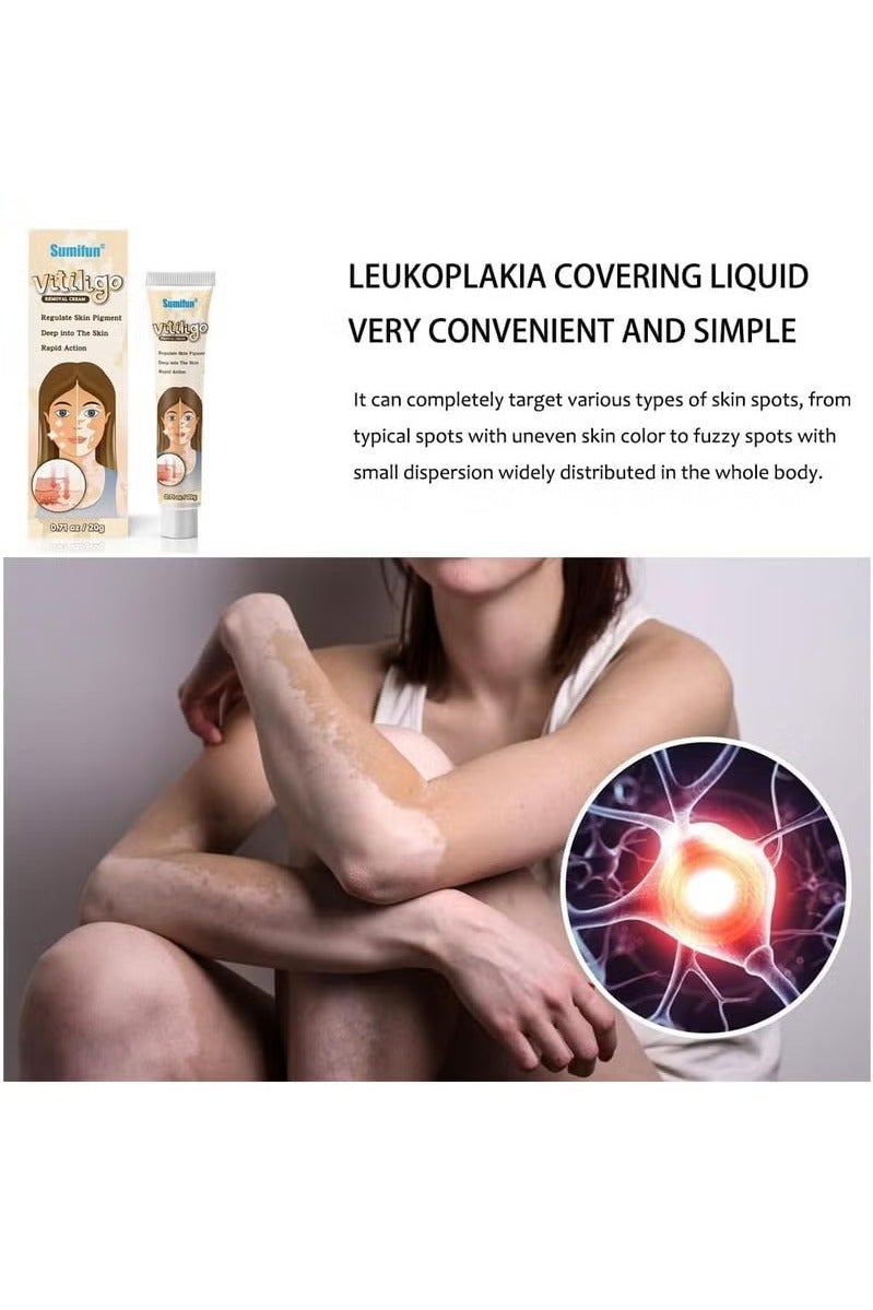 سوميفون كريم العناية بالبشرة فيتيليغو ، يقلل من البقع البيضاء ، وتحسين صبغة الجلد - Image 3