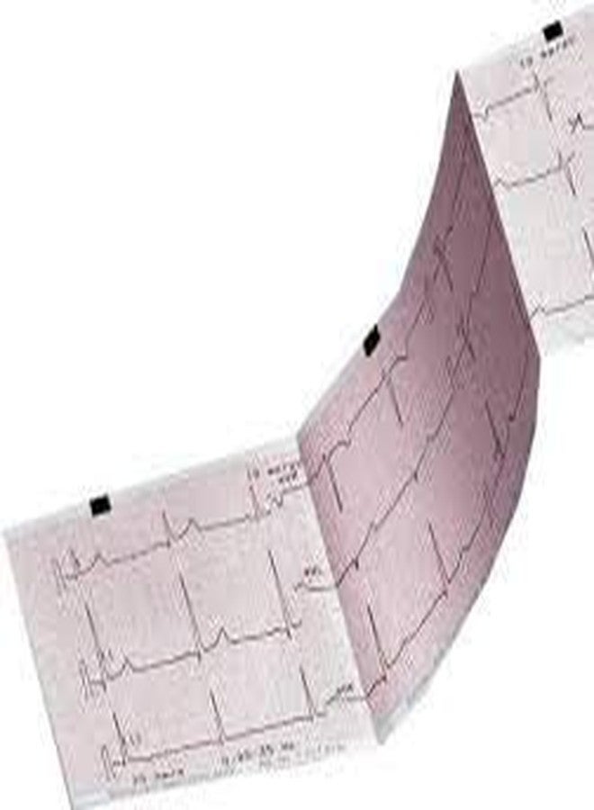 REVALS ورق حراري للطباعة من ريفالز بيست برينتينج BPL 6208 ECG، مقاس 80 مم × 20 متر - مجموعة من 6 لفات - Image 2