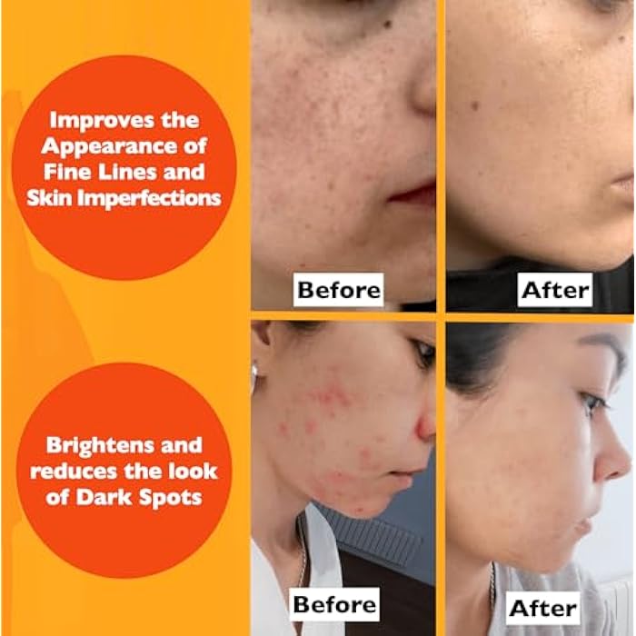 Florence Vitamin C Serum For Face – Anti Aging Face Serum with Vitamin C, Hyaluronic Acid, Vitamin E. Brightening Formula. Improve Appearance of Dark Spots, Tone, Fine Lines & Wrinkles, Glowing Skin 2 Fl Oz - Image 5