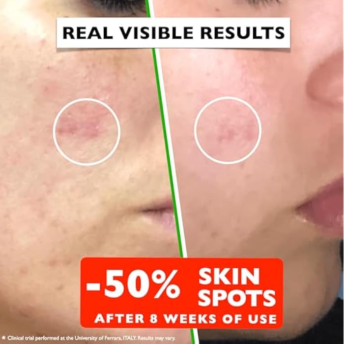 Florence Vitamin C Serum For Face – Anti Aging Face Serum with Vitamin C, Hyaluronic Acid, Vitamin E. Brightening Formula. Improve Appearance of Dark Spots, Tone, Fine Lines & Wrinkles, Glowing Skin 2 Fl Oz - Image 4