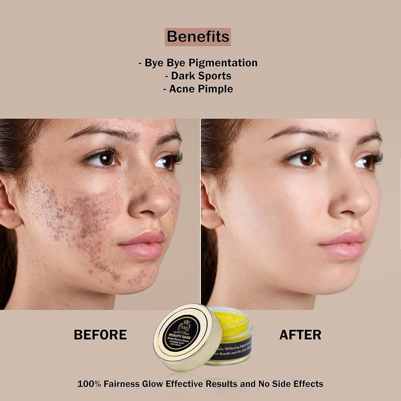 Mezco Pimple Scar Removal Cream Controls Acne Spot Pimples Pigmentation Removing Daily Skin Moisturizer for Girls Yellow Pack Of 1 - Image 2