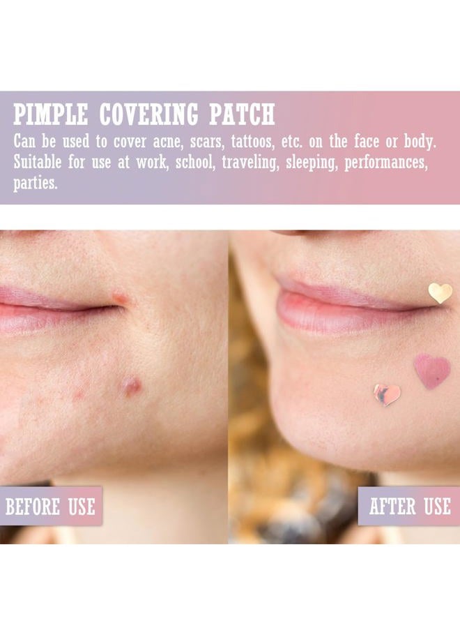 UPIQNG Pimple Patches Hydrocolloid Heart Shaped,5 Packs 108 Dots Waterproof Facial Pimple Stickers Blemish Cover Acne Stickers Zit Patchs Makeup Supplies - Image 3