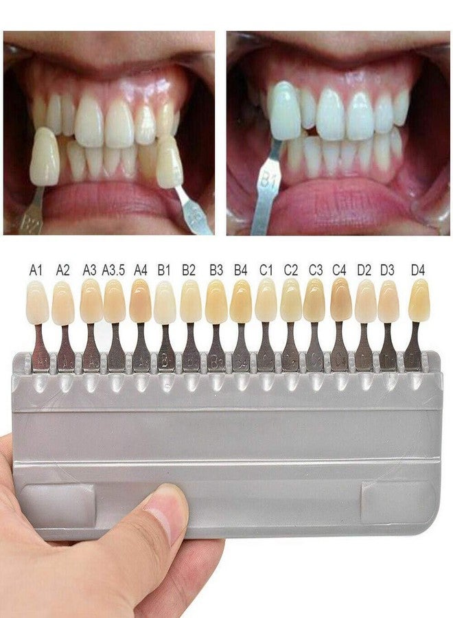 Smiledt 3D Teeth Whitening Shade Guide Porcelain - 16 Colors/Set Tooth Bleaching Shade Chart Mold - Tracking & Comparing - Dental Material Equipment - Oral Care - Image 4
