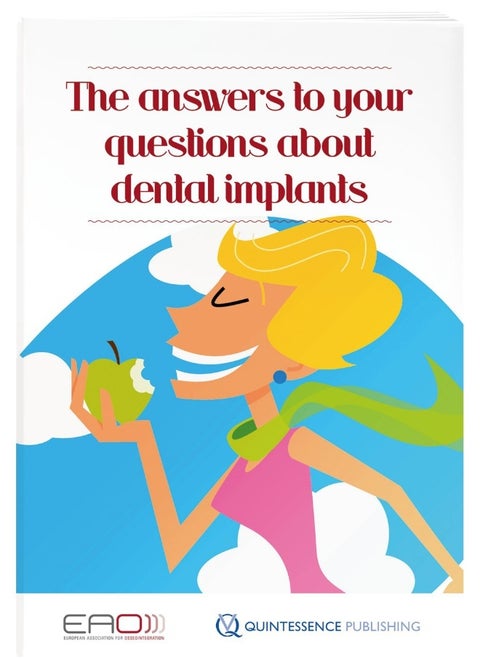 The answers to your questions about dental implants [9781850972792]